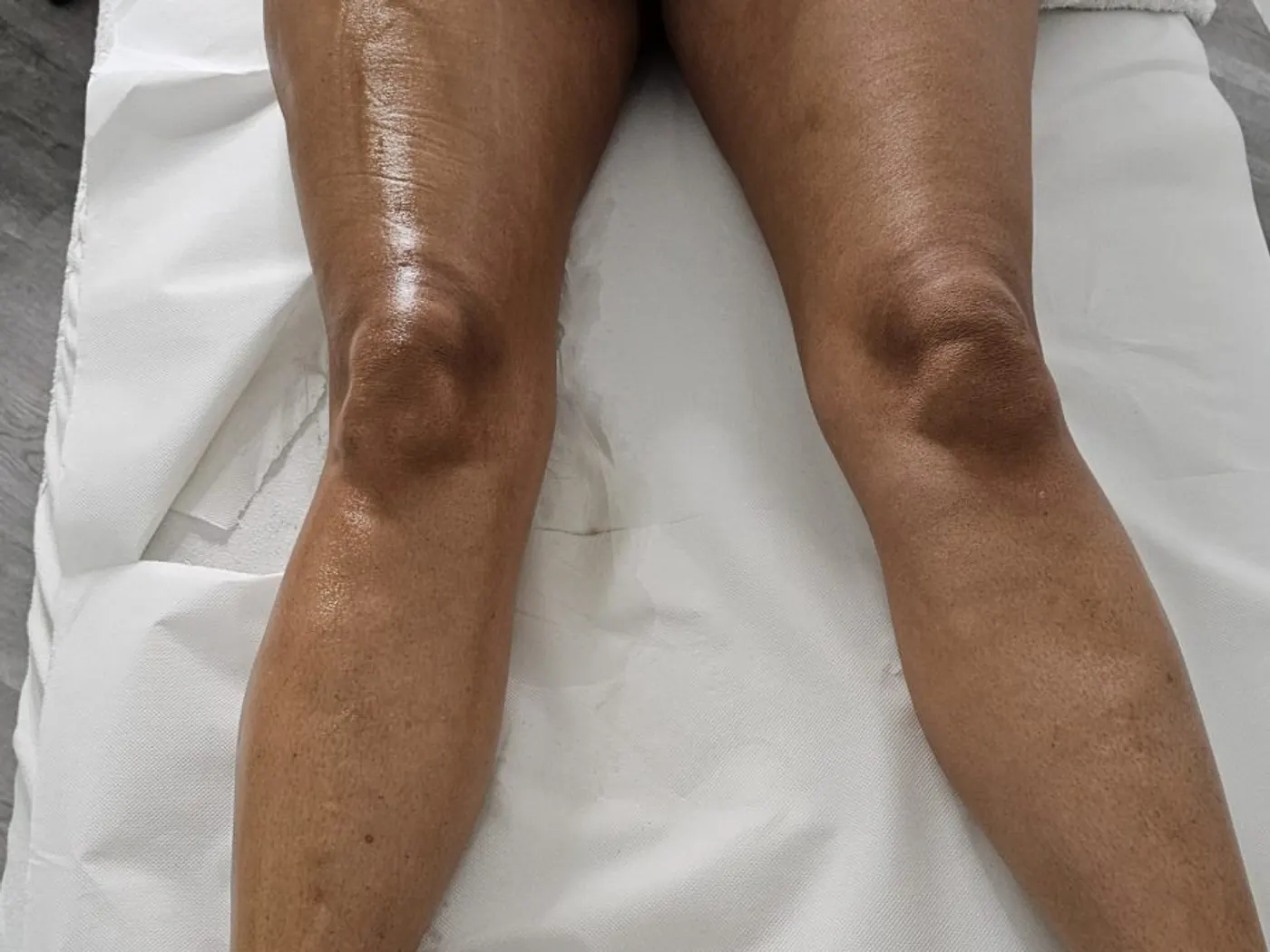 Jambes d’une cliente allongée sur le drap d’examen papier d’une table de soin.